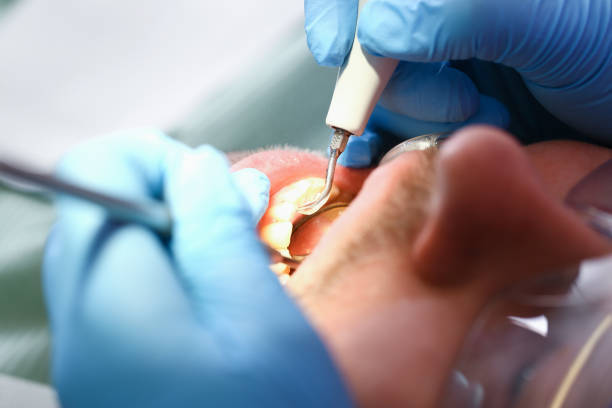 Best Urgent Care for Lost Fillings or Crowns in Ripley, OH